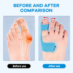 Vorgeschnittenes Hallux-Valgus Tape für Alltagsschuhe